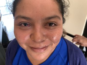 smiling patient after eye care
